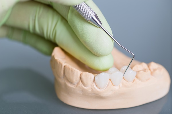 Dental Crown Procedures