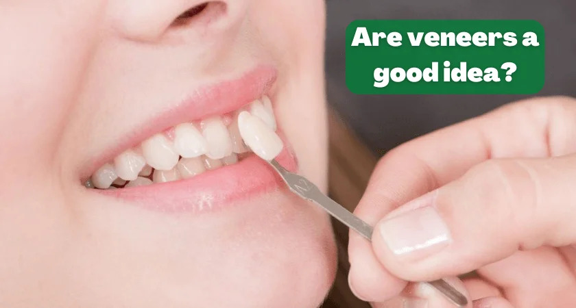Are veneers a good idea?