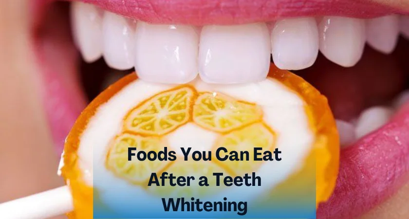 Foods You Can EatAfter a TeethWhitening