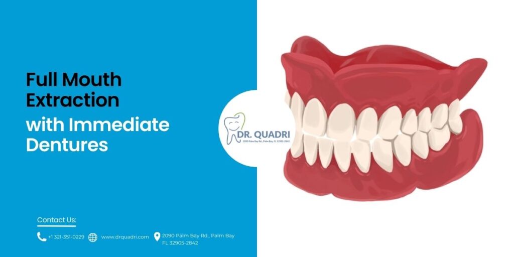 Full Mouth Extraction with Immediate Dentures