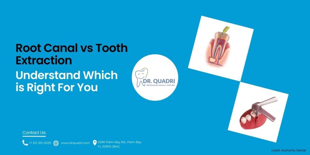 Root Canal vs Tooth Extraction Understand Which is Right For You