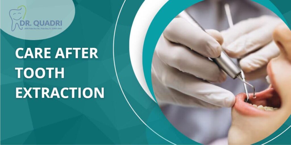 Care After Tooth Extraction