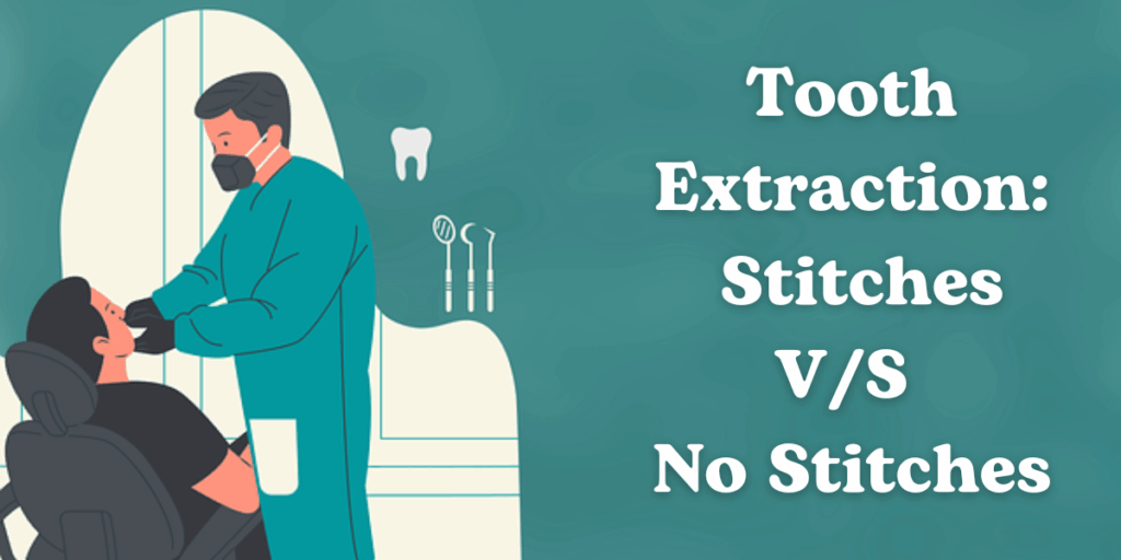 Tooth Extraction Stitches VS No Stitches