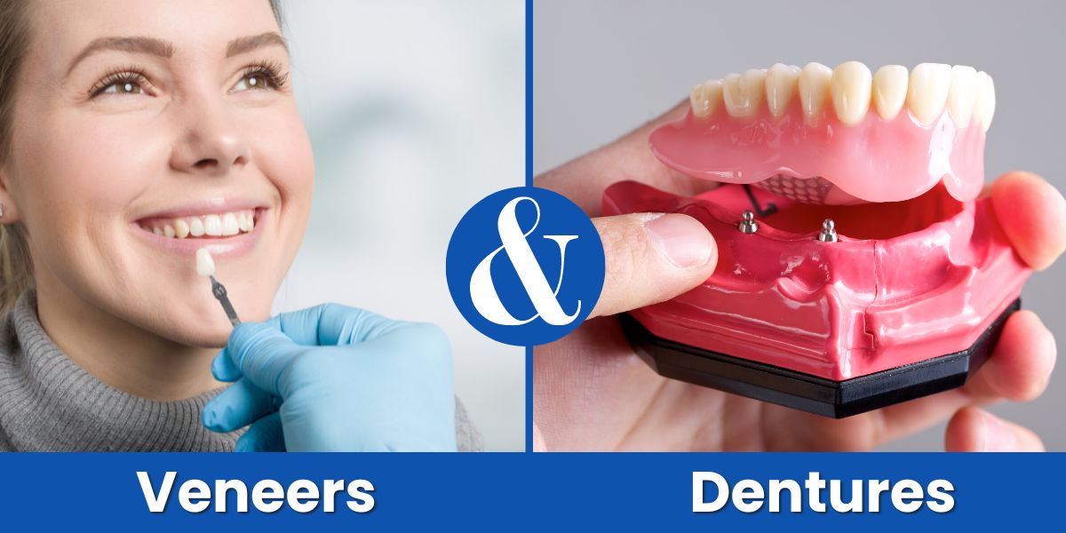 Difference Between Veneers and Dentures