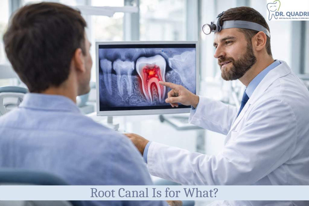 What is Root canel?