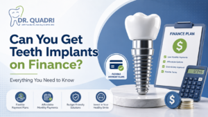 Can You Get Teeth Implants on Finance? Everything You Need to Know