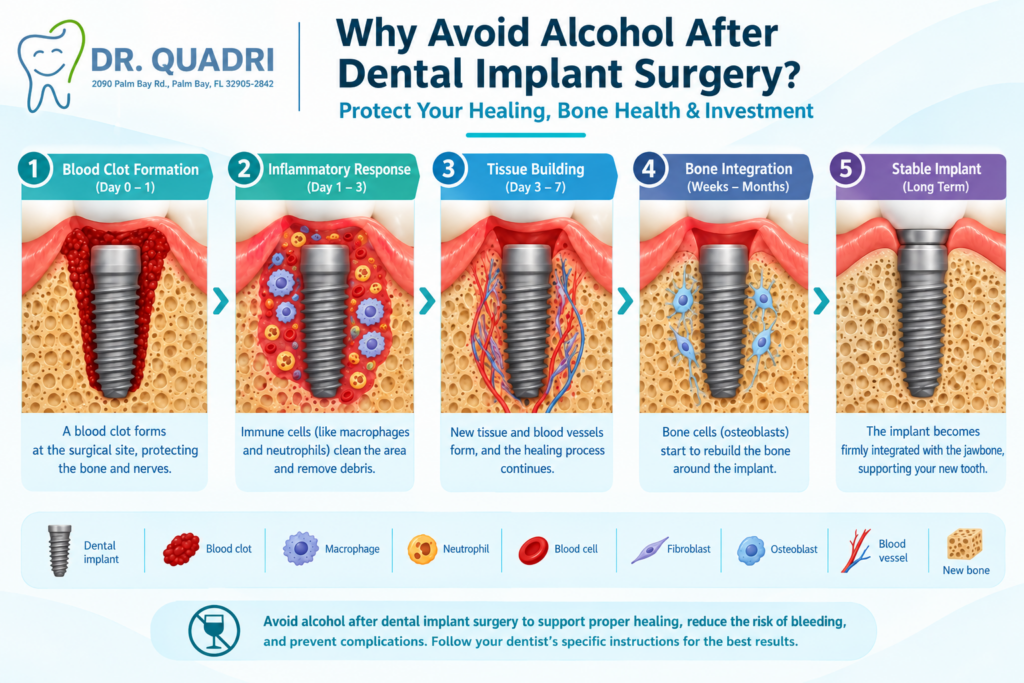 Dental Implant Surgery