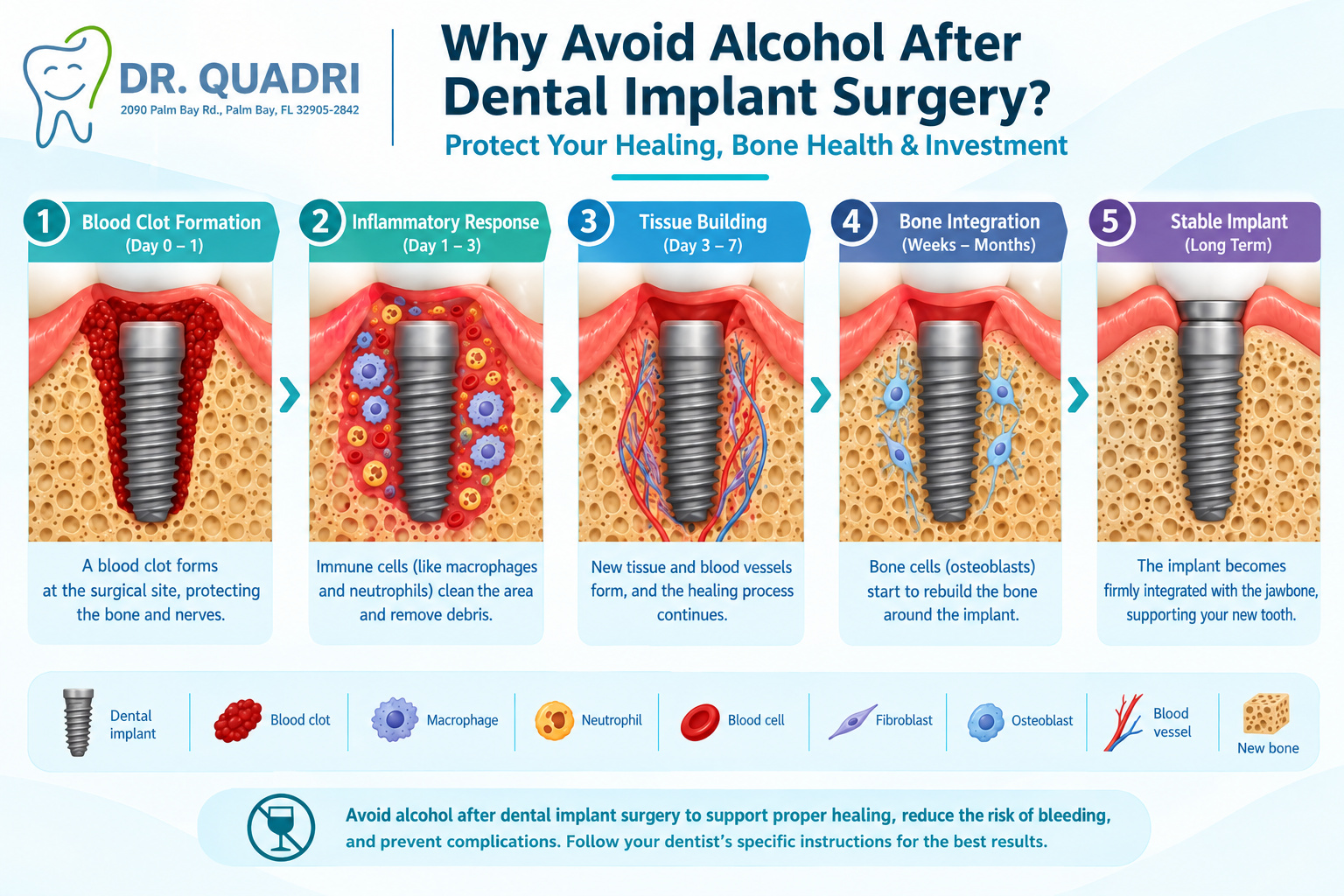 Dental Implant Surgery
